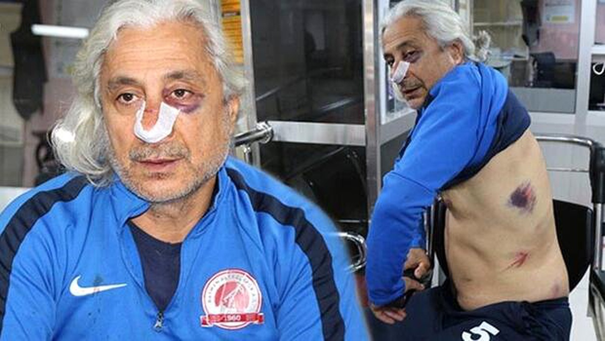 Teknik direktör ve futbolcularını demir sopalarla dövdüler