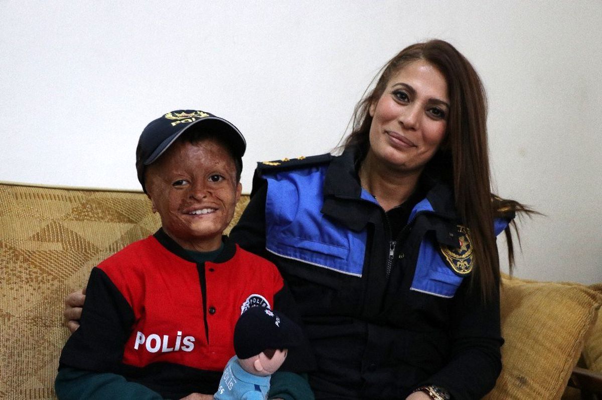 (Özel) Savaş mağduru Muhammed\'in polis olma hayali gerçek oldu