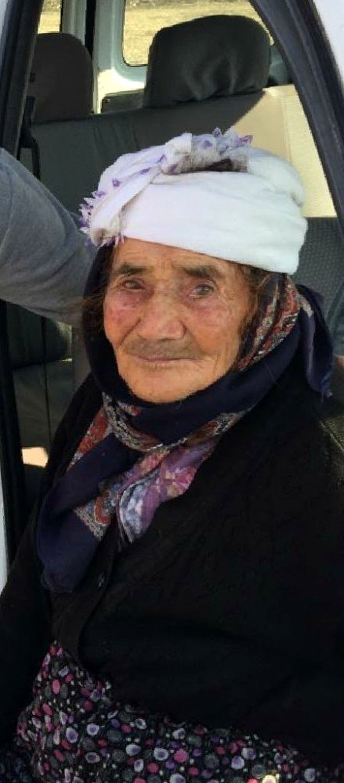 Sokak köpeği, yaşlı kadının yüzünü parçaladı