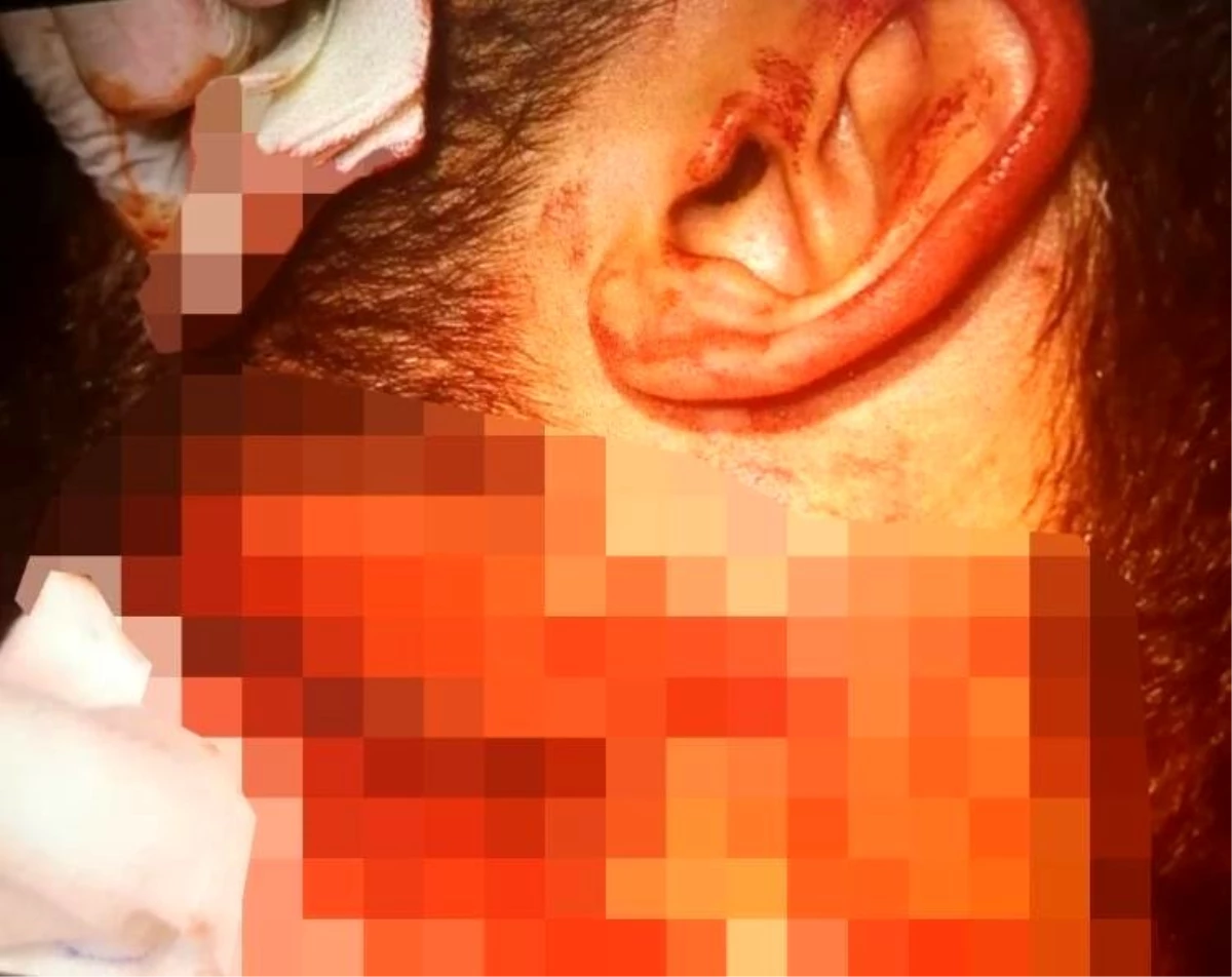 İzmir\'de doktora jiletli saldırıyı yapan zanlı: "Dövmeye gittim"