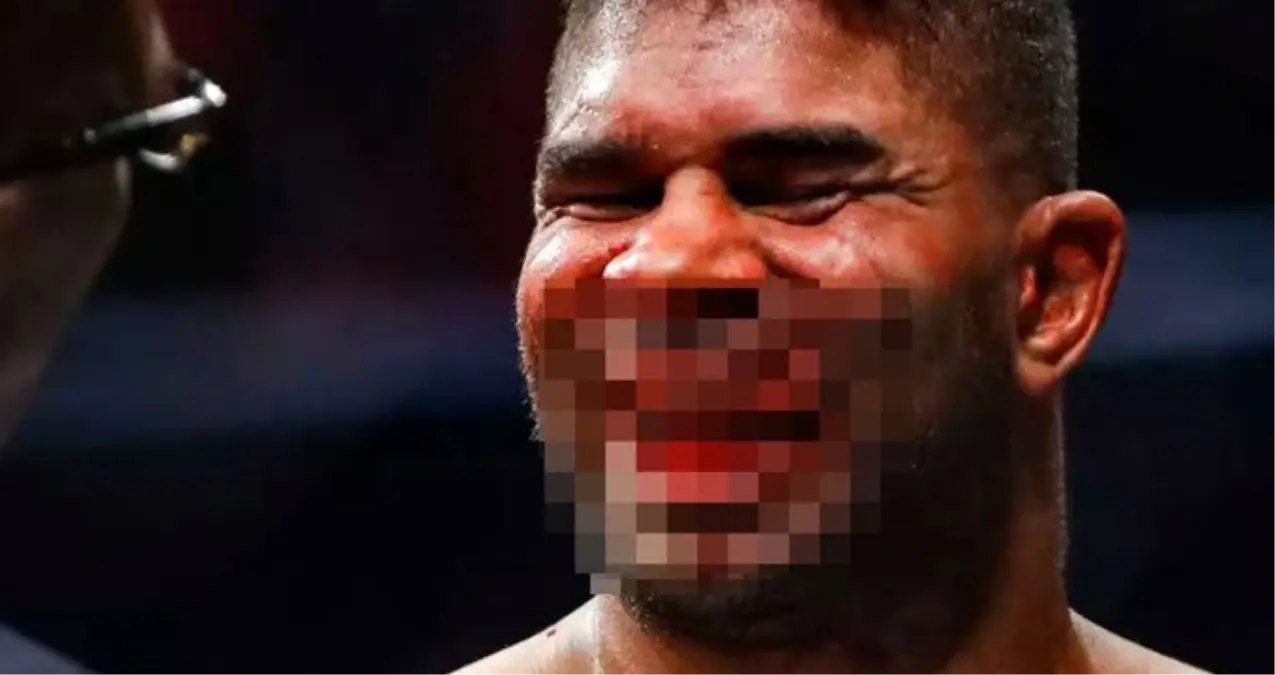 Jairzinho Rozenstruik, Alistair Overeem\'in dudağını kopardı