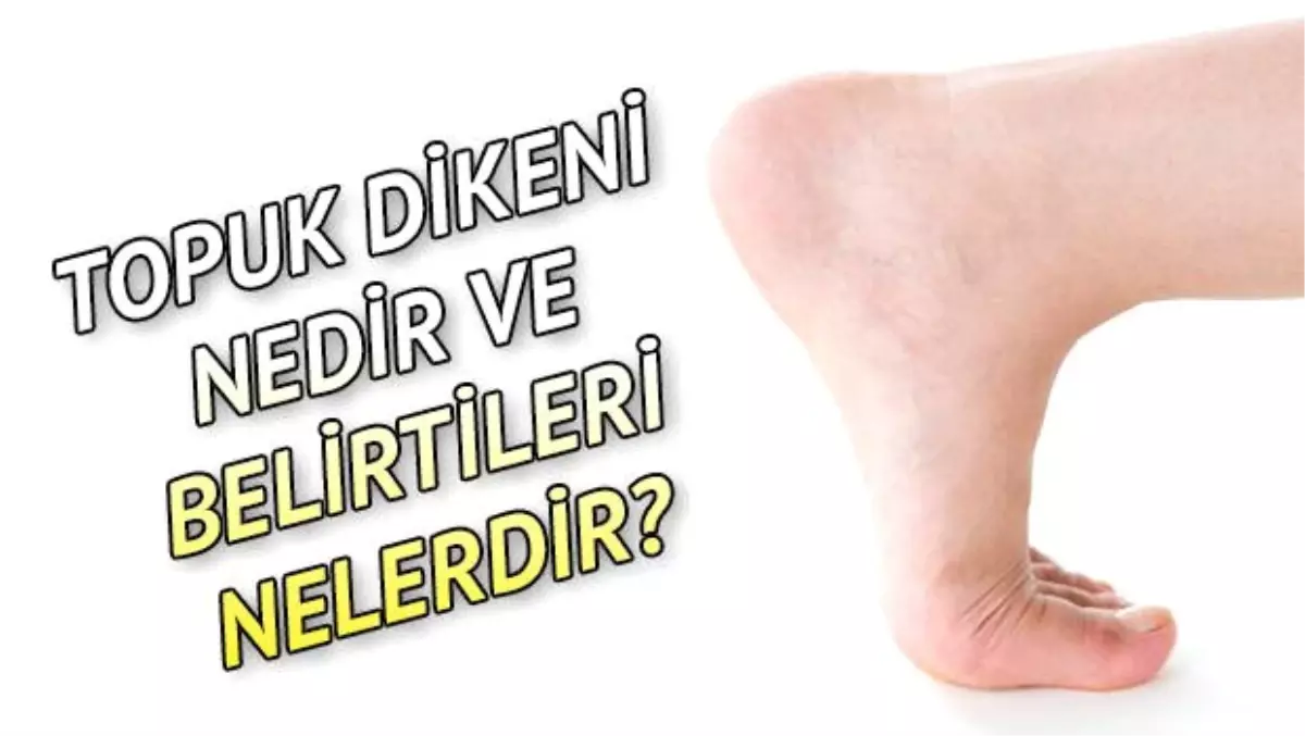 Topuk dikeni nedir? Topuk dikeni belirtileri nelerdir?