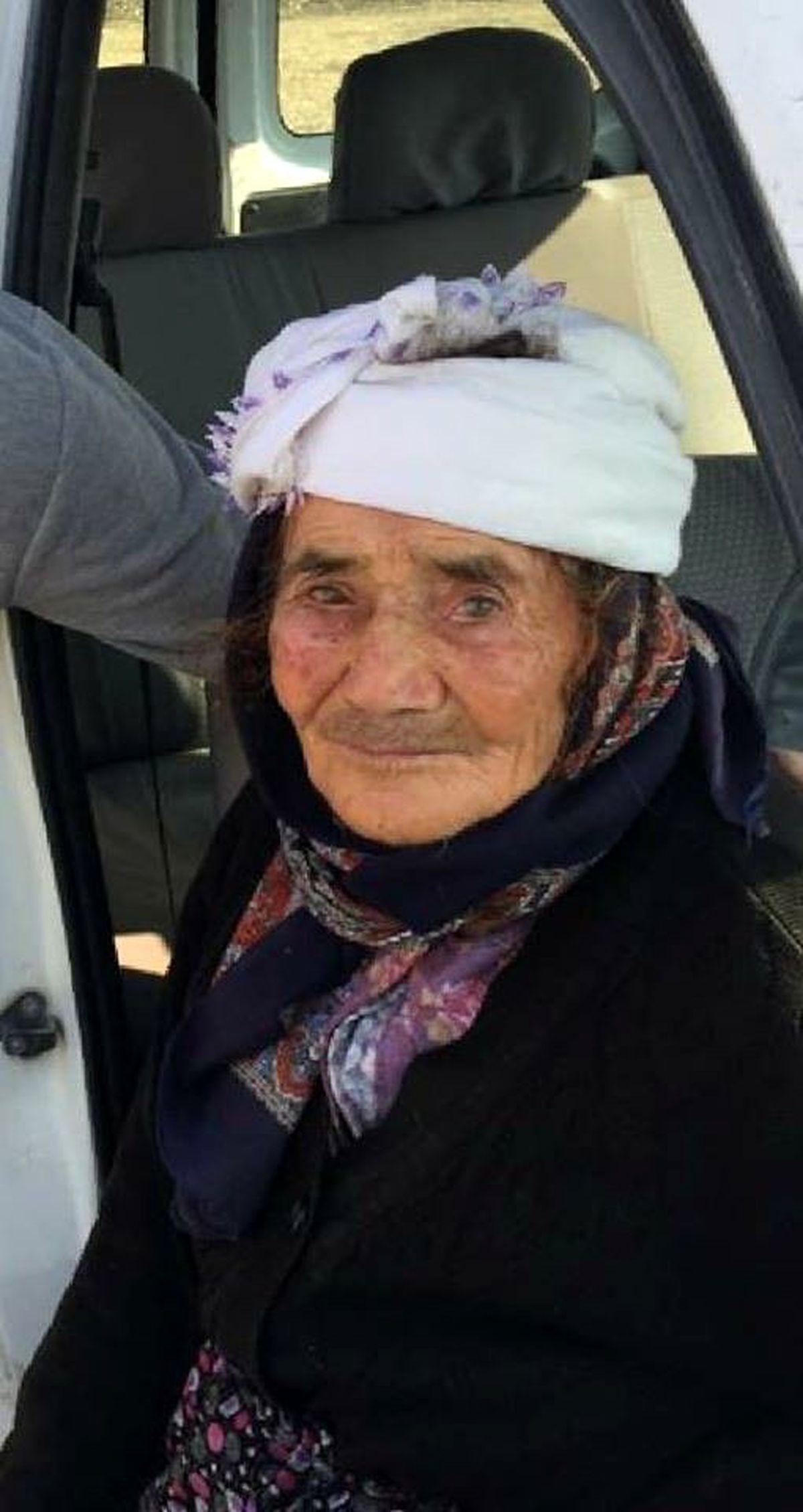 Yabani bir hayvan tarafından yüzü parçalanan kadın hayatını kaybetti