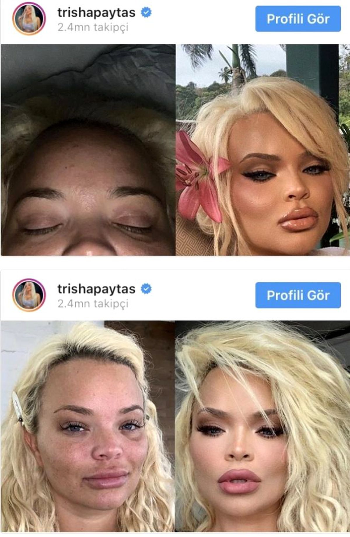 Instagram Fenomenlerinden Güzel Görüntüye Kanmayın Temalı 5 Fotoğraf