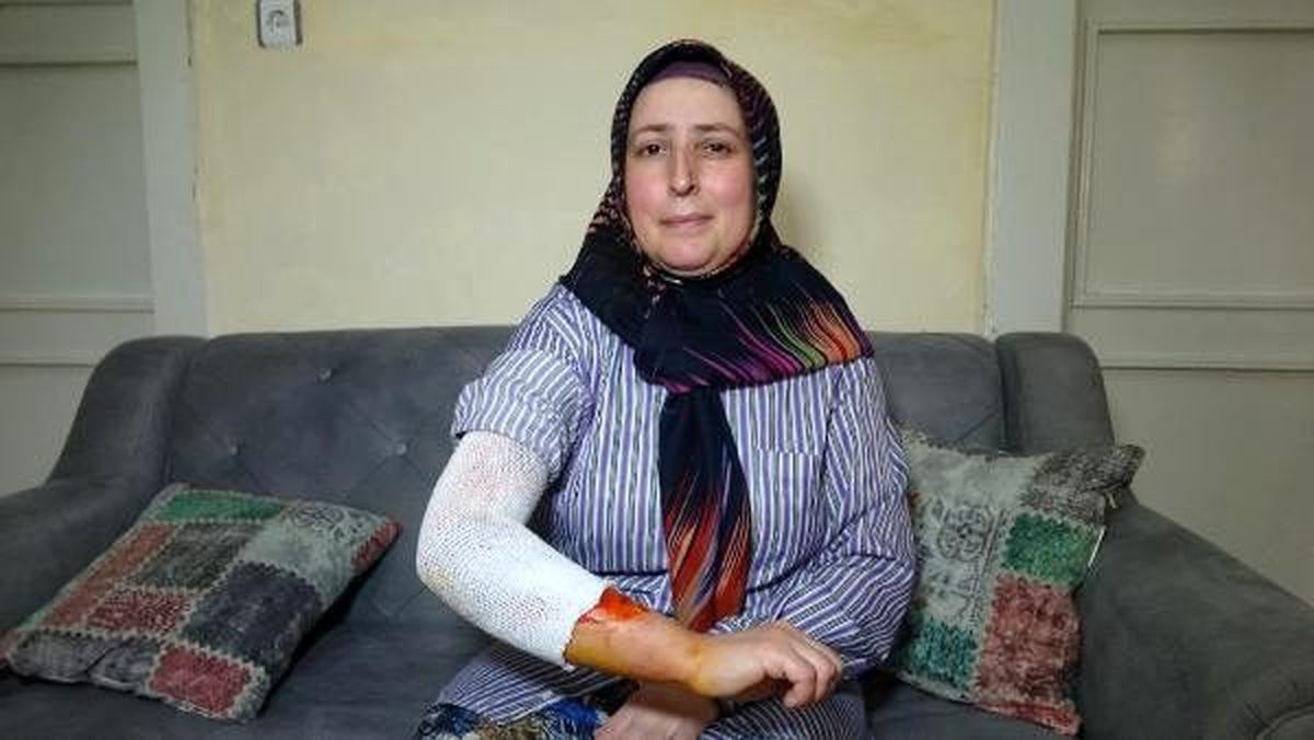 \'Misafiri yalnız bıraktın\' deyip, 2 çocuk annesi eşini sıcak suyla haşladı