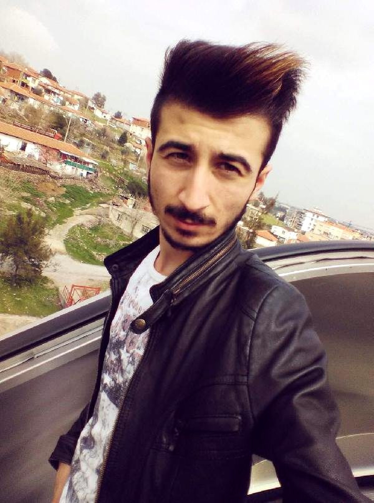 Alev alan tinerin kıyafetine sıçramasıyla tutuşan işçi, ağır yaralandı