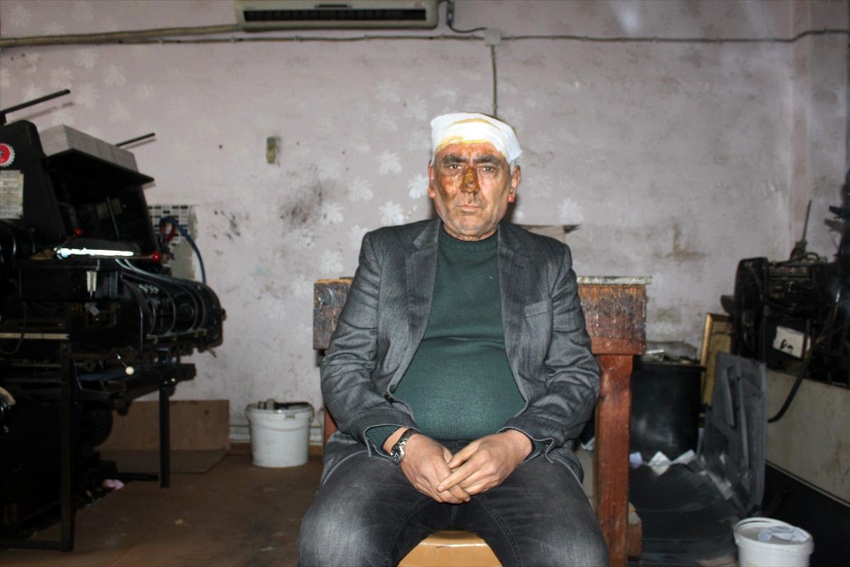Hatay\'da ev yangınında 2 kişi dumandan etkilendi