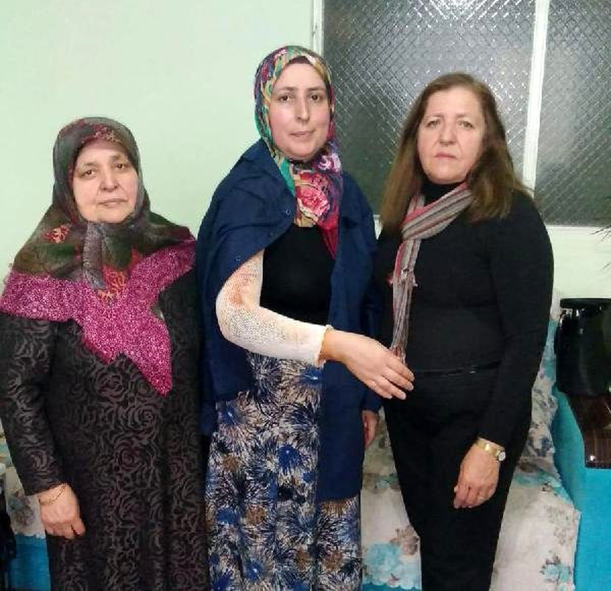 Eşi tarafından kolu yakılan kadına destek