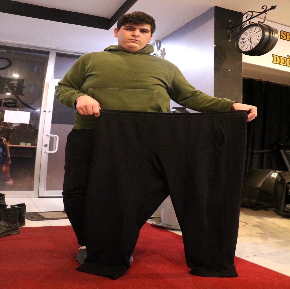 Ağırlığına teraziler dayanamıyordu: 116 kilo verdi