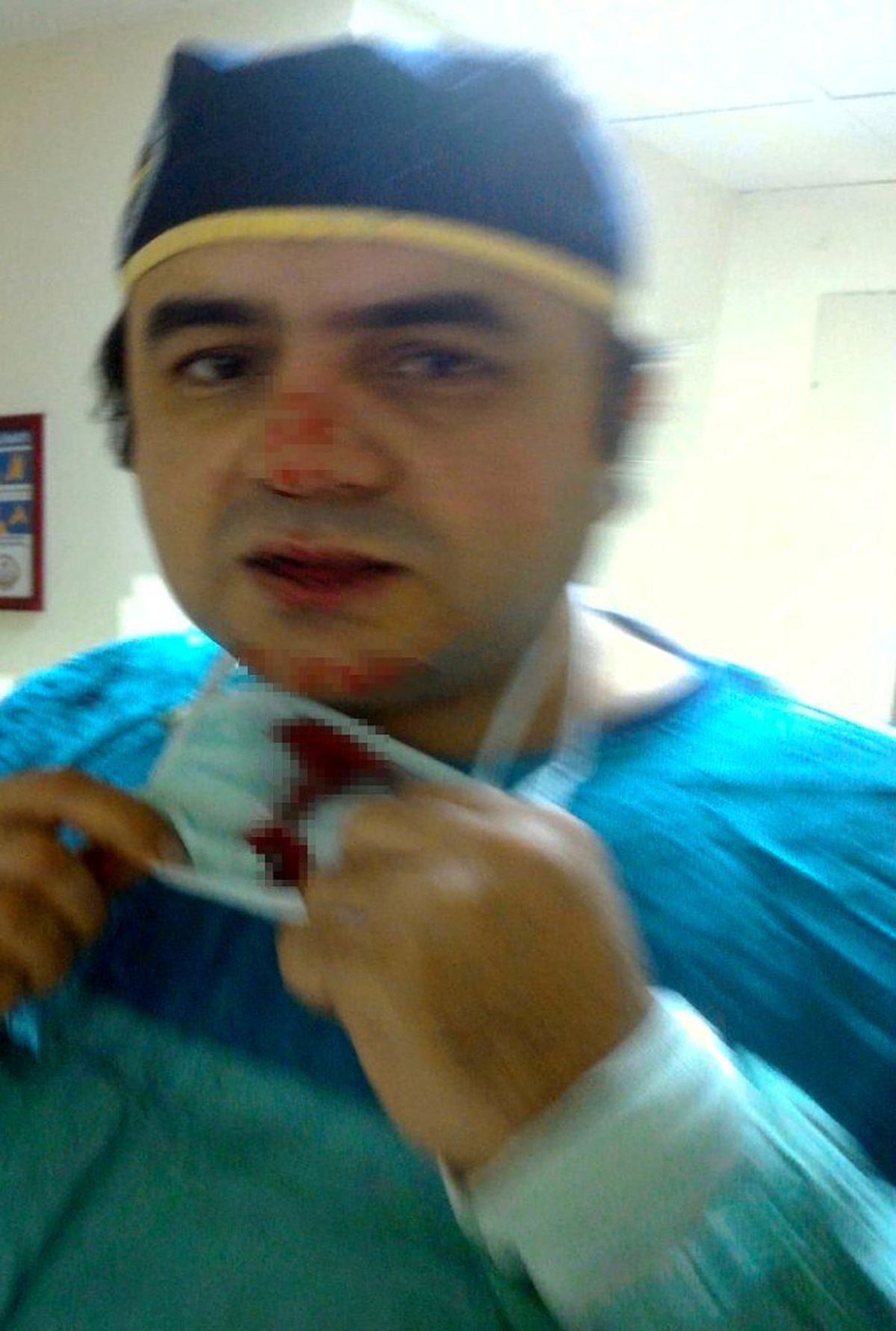 Osmaniye\'de doktoru darp edip burnunu kıran saldırgan tutuklandı