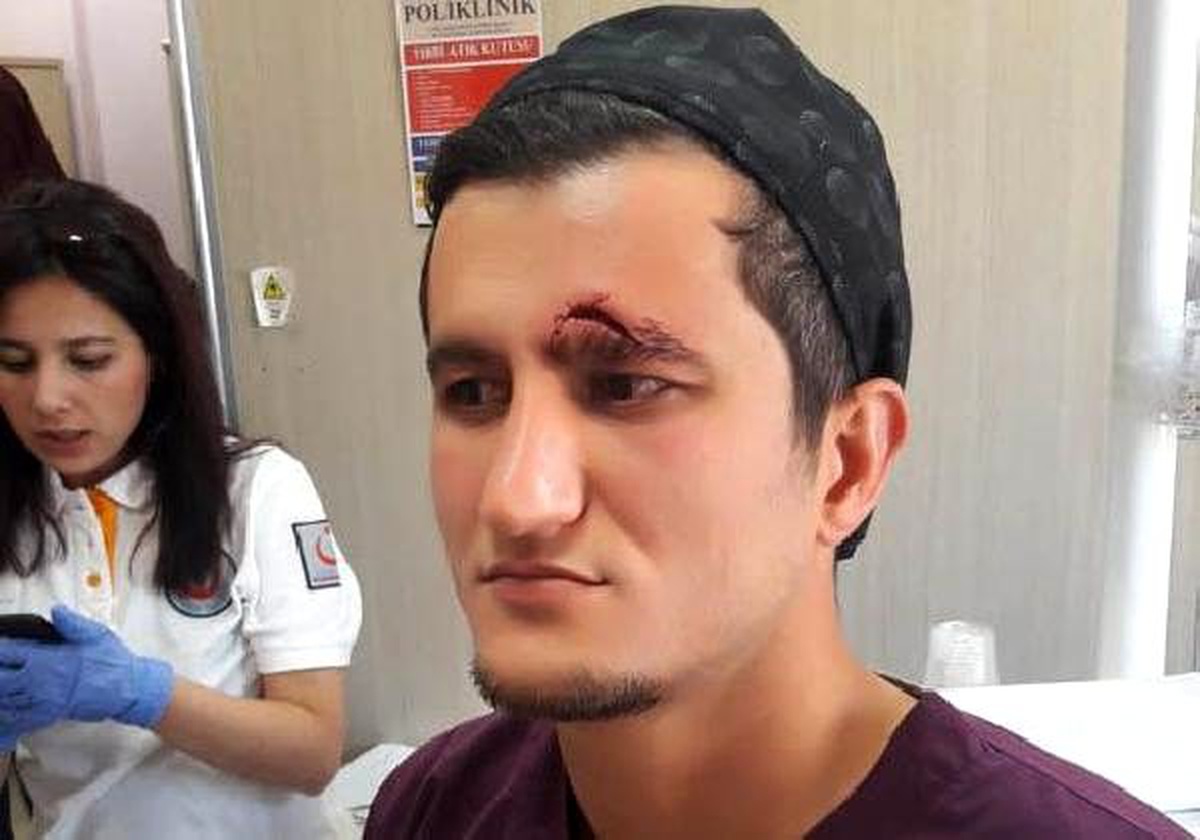 Diş hekimine saldırı davası sanığına 4 yıl hapis