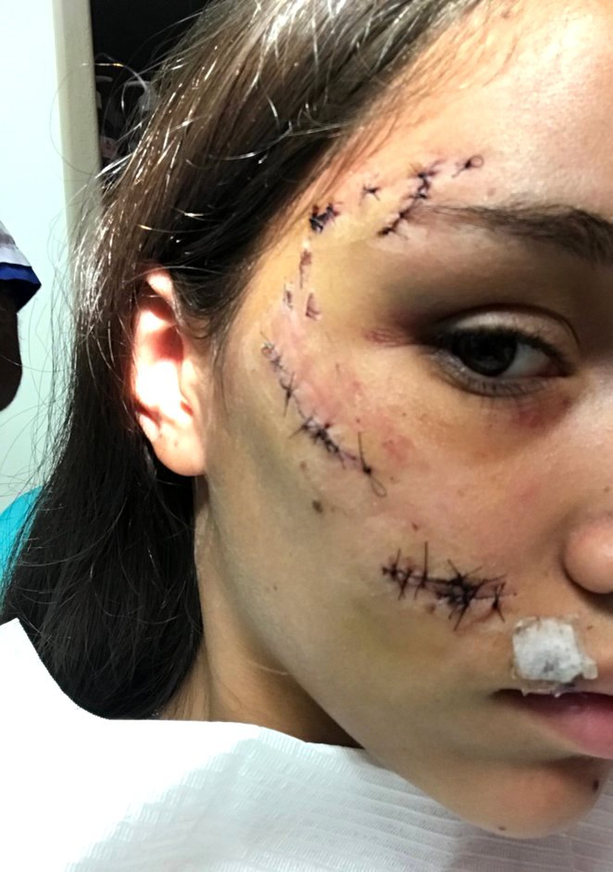 Köpeğiyle Fotoğraf Çektirmeye Çalışan Kızın Kötü Sonu (+18)