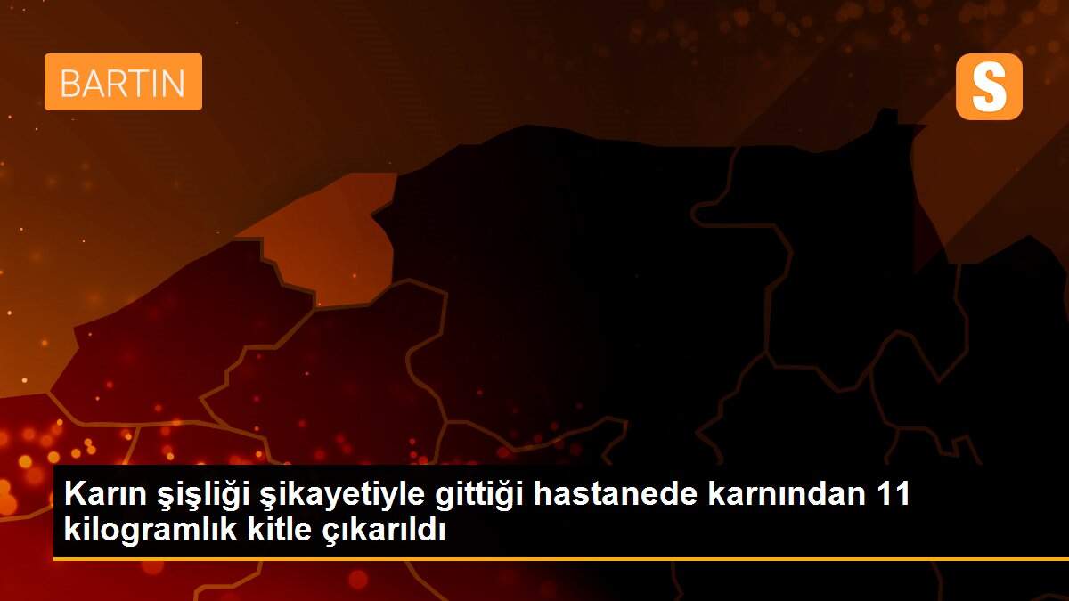 Karın şişliği şikayetiyle gittiği hastanede karnından 11 kilogramlık kitle çıkarıldı