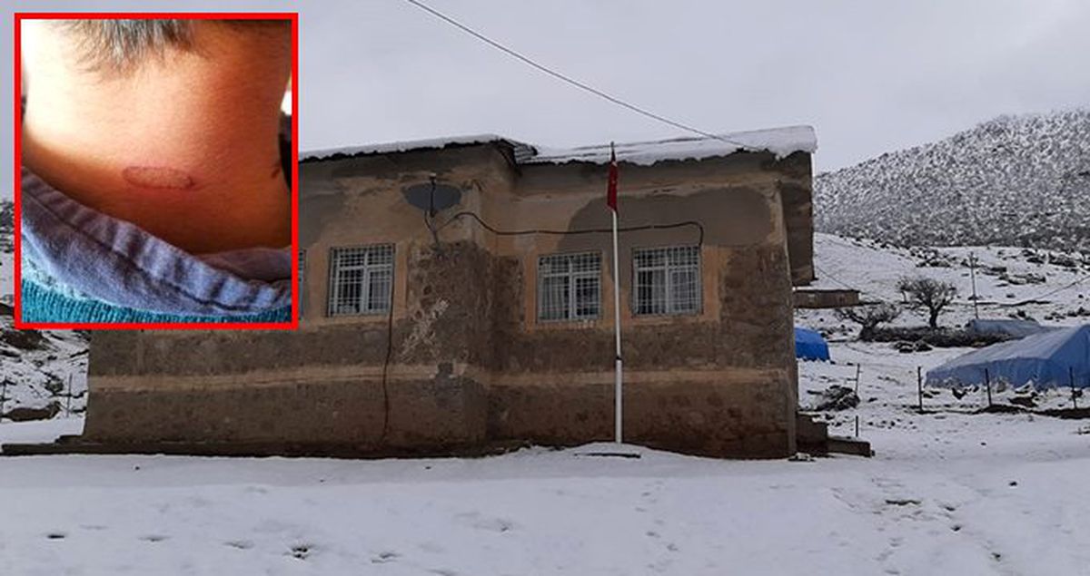 Öğrencilerin vücuduna sıcak soba maşası değdiren öğretmen açığa alındı