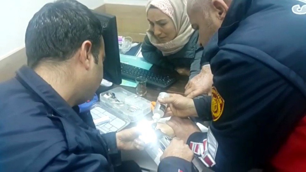 Parmağına sıkışan yüzük kesilerek çıkartıldı