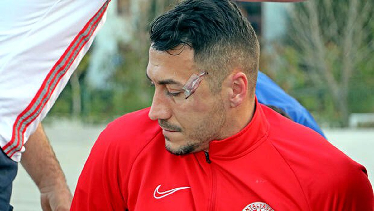 Antalyaspor\'dan Adis Jahovic korkuttu! Kafasında çatlak tespit edildi