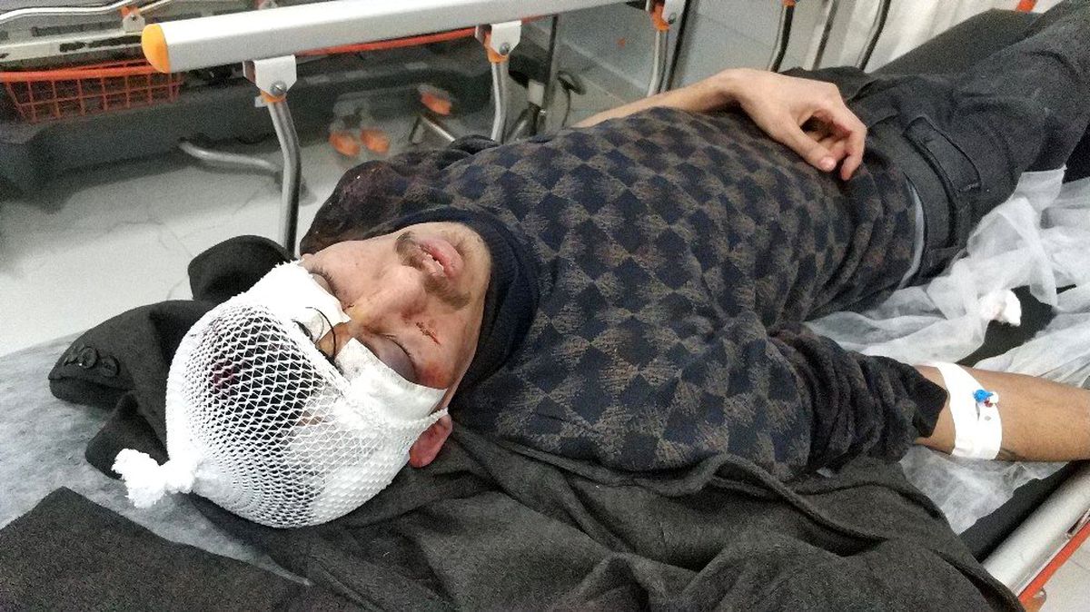 Evin kapısını kırıp sopayla 2 kişiyi hastanelik ettiler