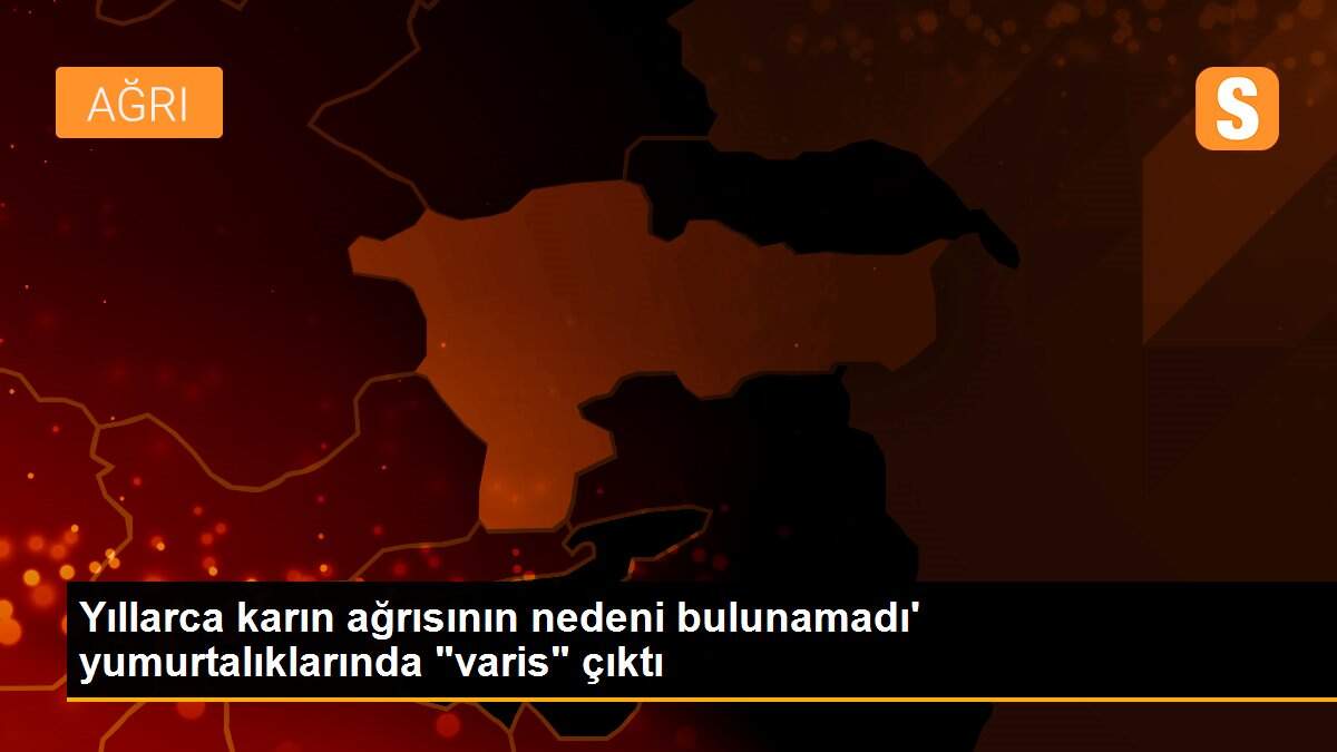 Yıllarca karın ağrısının nedeni bulunamadı\' yumurtalıklarında "varis" çıktı