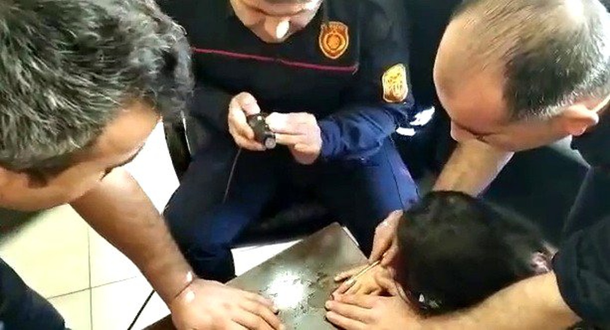 Parmağındaki yüzük kesilerek çıkarıldı