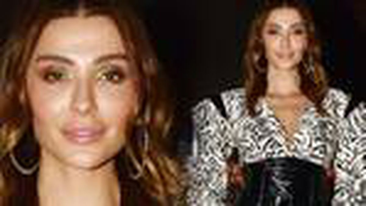 Özge Ulusoy\'dan estetik iddialarına yanıt