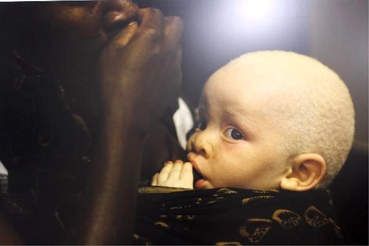 \'Kara Kıtanın Beyaz Çocukları\': Afrikalı albinoların dramı sanatseverlerle buluştu