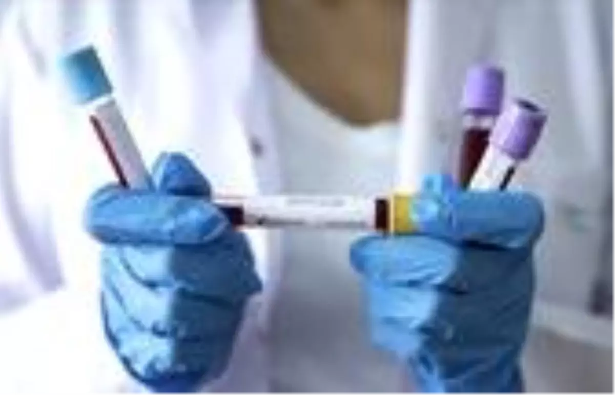 İran Sağlık Bakan Yardımcısında koronavirüs tespit edildi