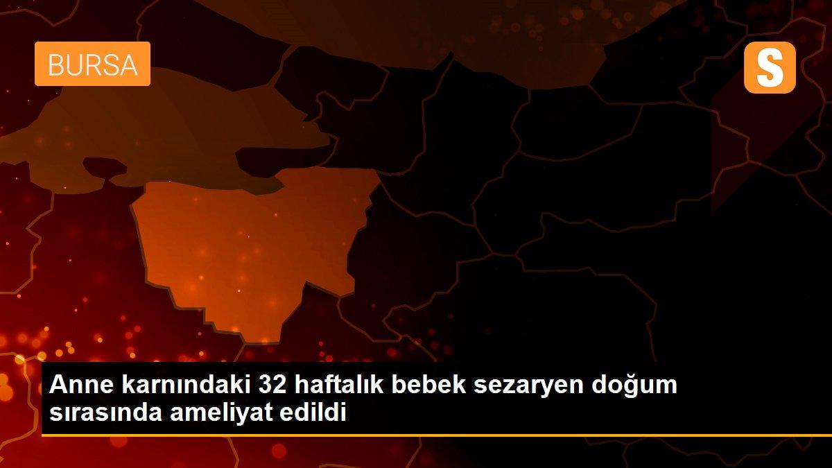 Anne karnındaki 32 haftalık bebek sezaryen doğum sırasında ameliyat