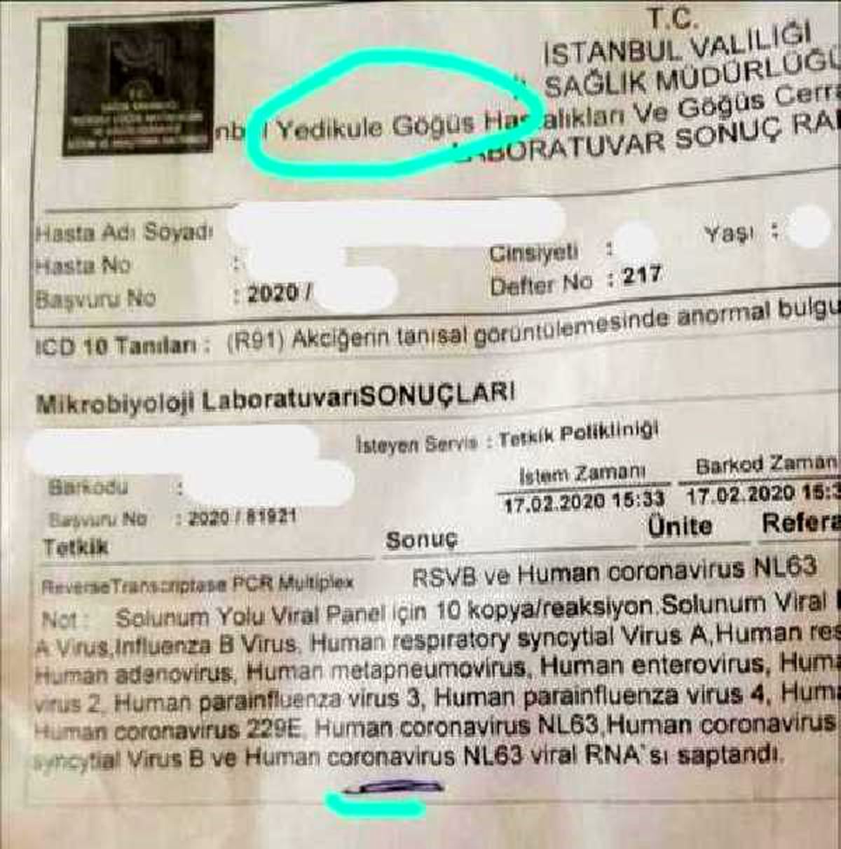Bakan Koca\'dan, Yedikule Hastanesi\'ndeki \'koronavirüs\' iddiasına\' ilişkin açıklama