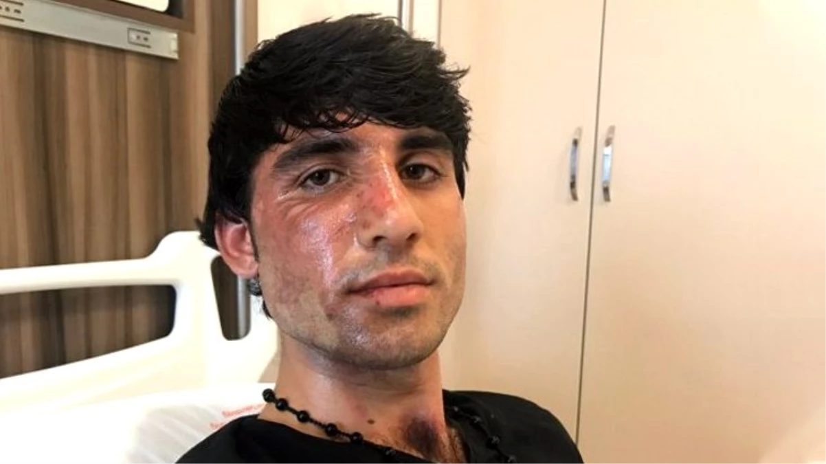 Yunanistan polisi, Avrupa\'ya gitmek isteyen Afgan mültecinin yüzüne kaynar su attı