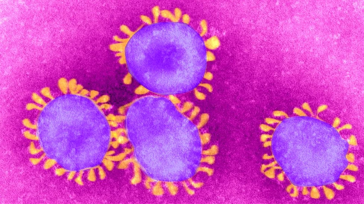 Pandemi nedir, koronavirüs pandemik hastalık ilan edilir mi?
