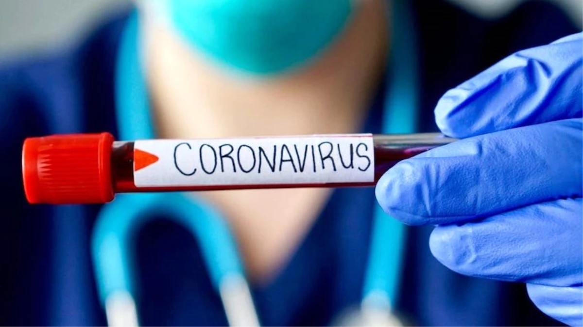 Amerika\'da Yaşayan Türk Çift, Koronavirüs Test Kiti Üretti