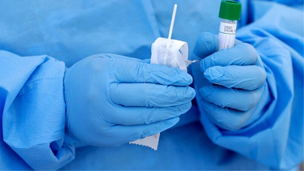 Fırsatçılar bedava olan koronavirüs testlerini 1.250 TL\'ye yapıyor