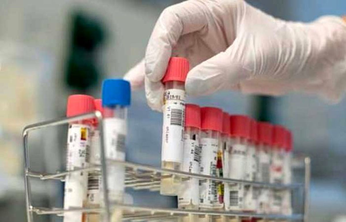 Dünya genelinde Kovid-19\'u atlatan kişi sayısı 102 bini geçti