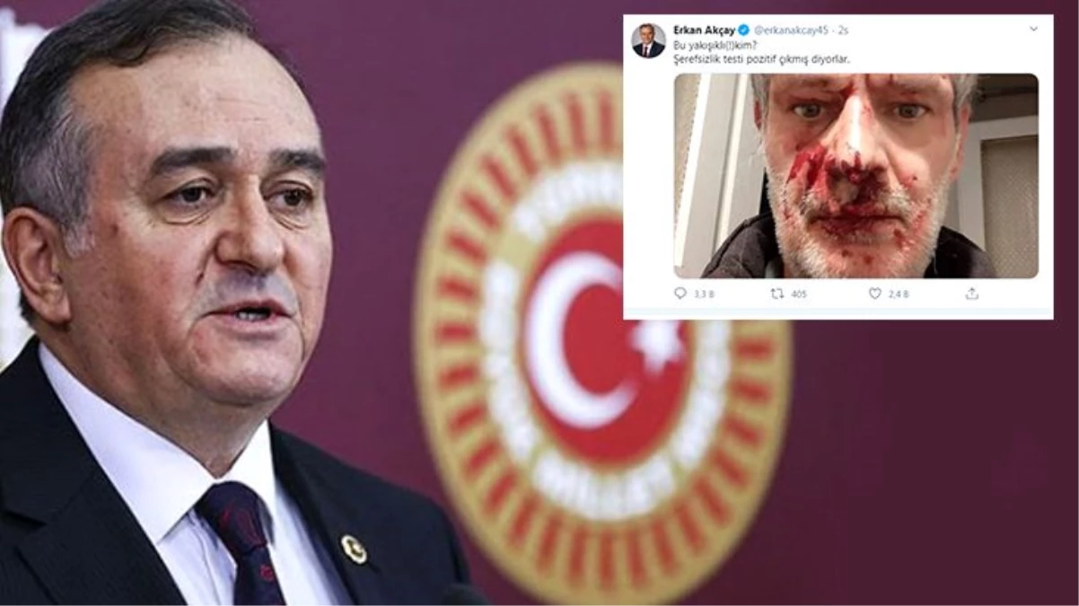 MHP\'li Grup Başkanvekili Erkan Akçay, darp edilen yazarın fotoğrafını paylaştı