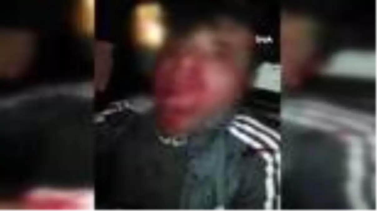 Dövüp hastanelik ettiler, görüntüyü sosyal medyadan paylaştılar