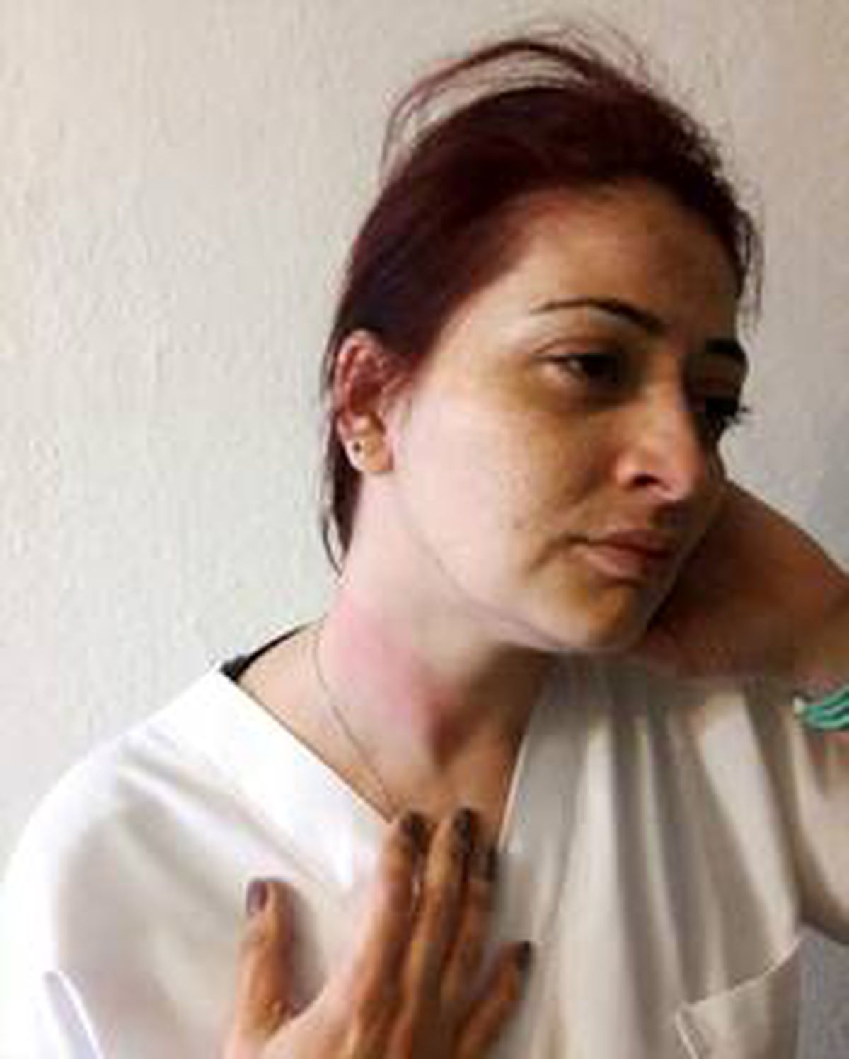 İzmir\'de sağlık çalışanına yönelik darp iddası