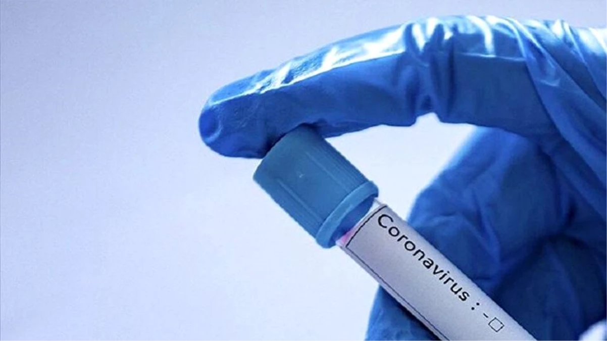 Sakarya Üniversitesi\'nin koronavirüsle ilgili aşı geliştirme projesi kabul edildi