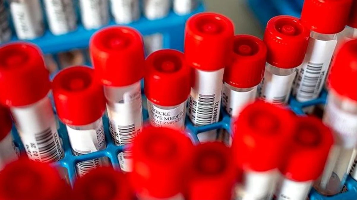 Sağlık Bakanlığı Referans Laboratuvarı\'nda koronavirüsün parmak izi ortaya çıkarıldı
