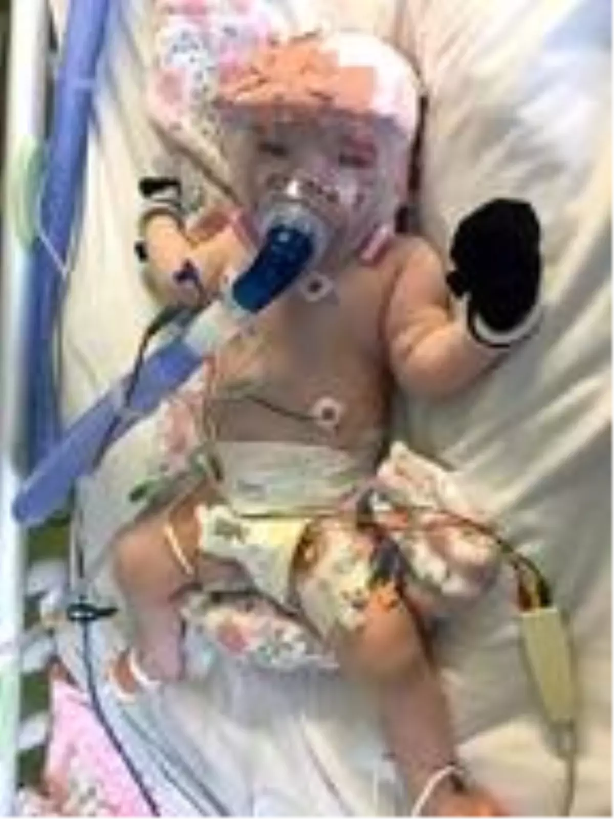 İngiltere\'de altı aylık bebeğe koronavirüs teşhisi konuldu