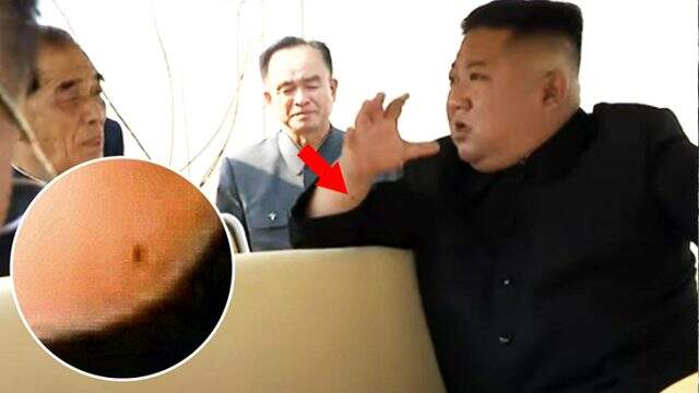 Haftalar sonra ortaya çıkan Kim'in, bileğindeki yara detayı dikkat çekti