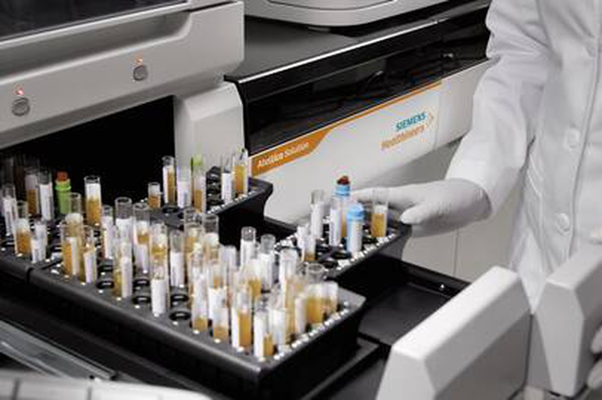 Siemens Healthineers, yüzde 99,8 hassaslıkta test kitini geliştirdi