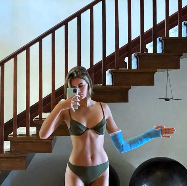Model Kaia Gerber, Instagram'da bikinili pozunu paylaşarak kolunu kırdığını söyledi