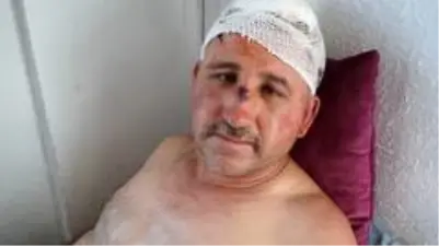 taciz iddiasiyla kari koca tarafindan olduresiye dovulen adam cinsel organinin tekmelendigini soyledi son dakika