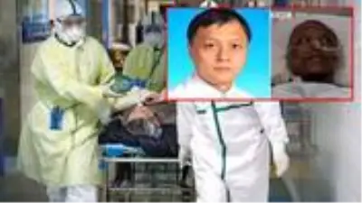 Koronavirüse yakalanan ve ten rengi koyulaşan Çinli doktor Hu Weifeng hayatını kaybetti Koronavirüse yakalanan ve ten rengi koyulaşan Çinli doktor Hu Weifeng hayatını kaybetti