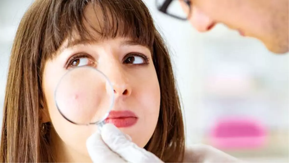 Benler ne zaman tehlike? Dermatolog Dr. Neslihan Dolar yazdı