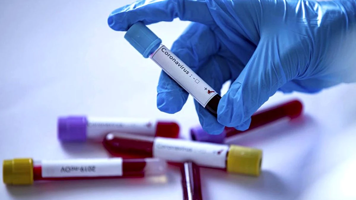 Hangi Kan Grubunun Koronavirüs Riski Daha Fazla? Uzmanlar Açıkladı!