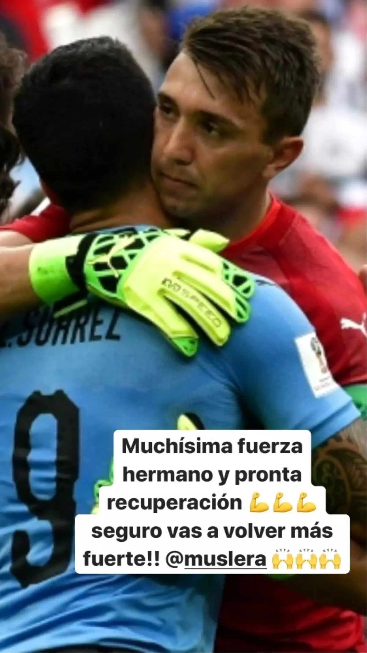 Luis Suarez\'den Muslera\'ya geçmiş olsun mesajı