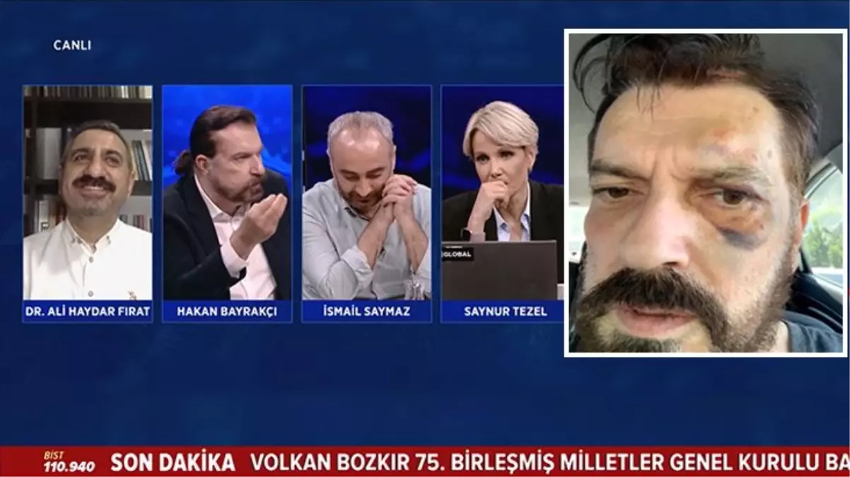 Ünlü anketçi Hakan Bayraktar\'dan 1 yıl sonra gelen itiraf: Teke tek çağırdım, 5 kişi gelip saldırdılar