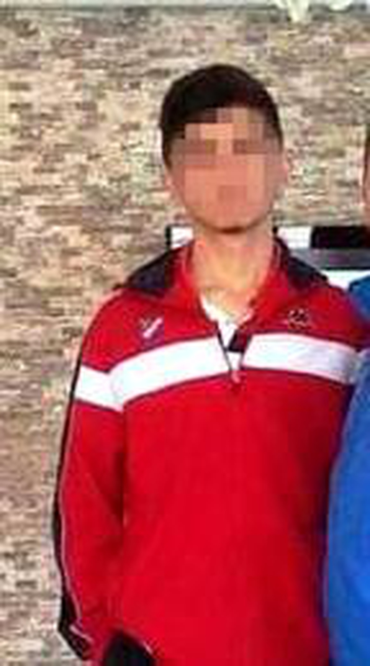 Son dakika haberi | Piknikte bacağına yapışan kene hastanede çıkarıldı