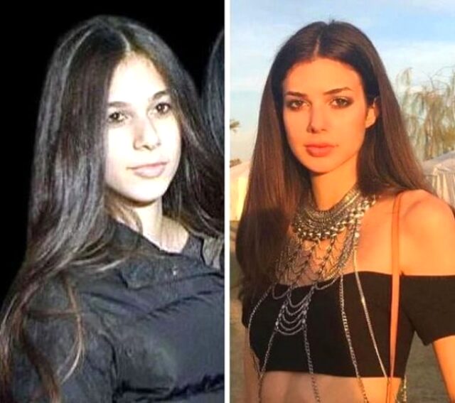 Defne Samyeli'nin kızı Deren Talu'nun estetiksiz görüntüsü ortaya çıktı